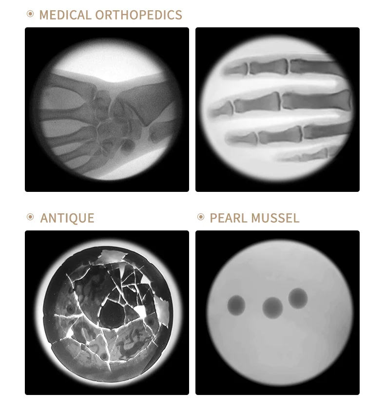 Instrumento de fluoroscopia de rayos X para la industria electrónica, imagen en tiempo Real de tipo erigido