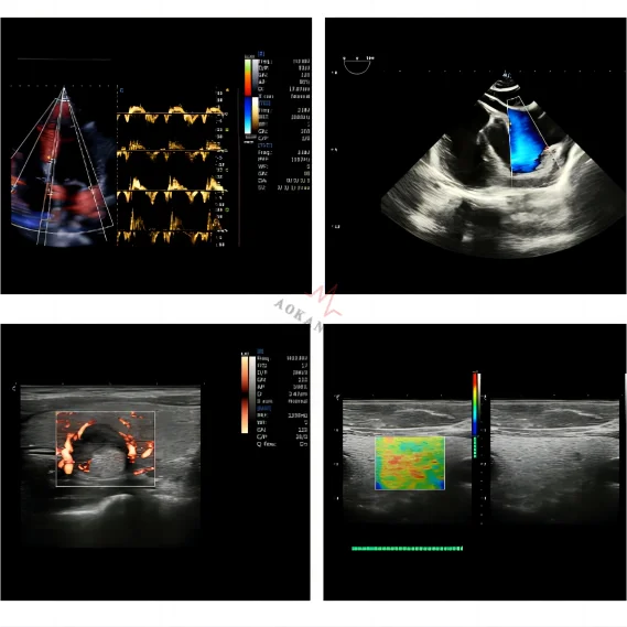 Cart-based Ultrasound Machine CHISON SonoMax 7 Stationary Ultrasound Scanner Precision Diagnostics for Healthcare Providers