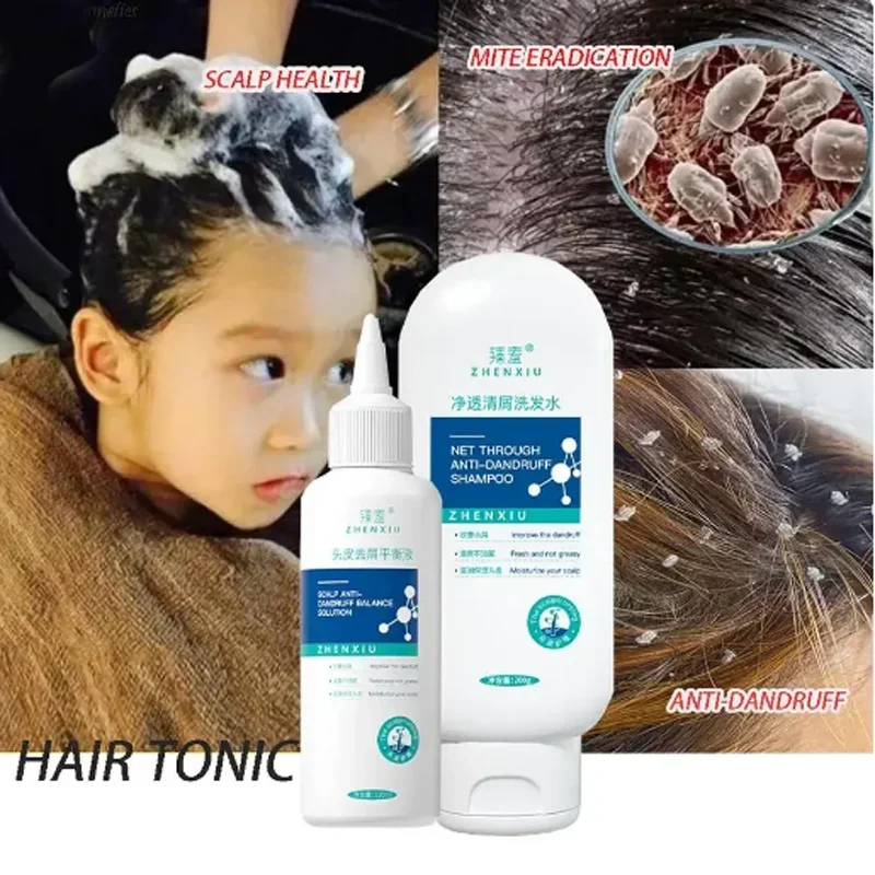 Anti Hair Loss Lice Mites Remover Liquid Shampoo Anti Dandruff Shampoo Treatment Oil Control Refreshing Scalp Follicle Dissolve