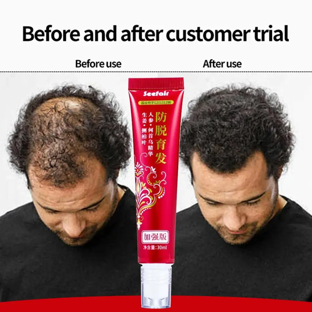 تدليك الأسطوانة Platycladus Orientalis مكافحة تساقط الشعر بوليغونوم متعدد الأزهار الزنجبيل السائل الأسطوانة فروة الرأس الشعر السائل V5M6 #6