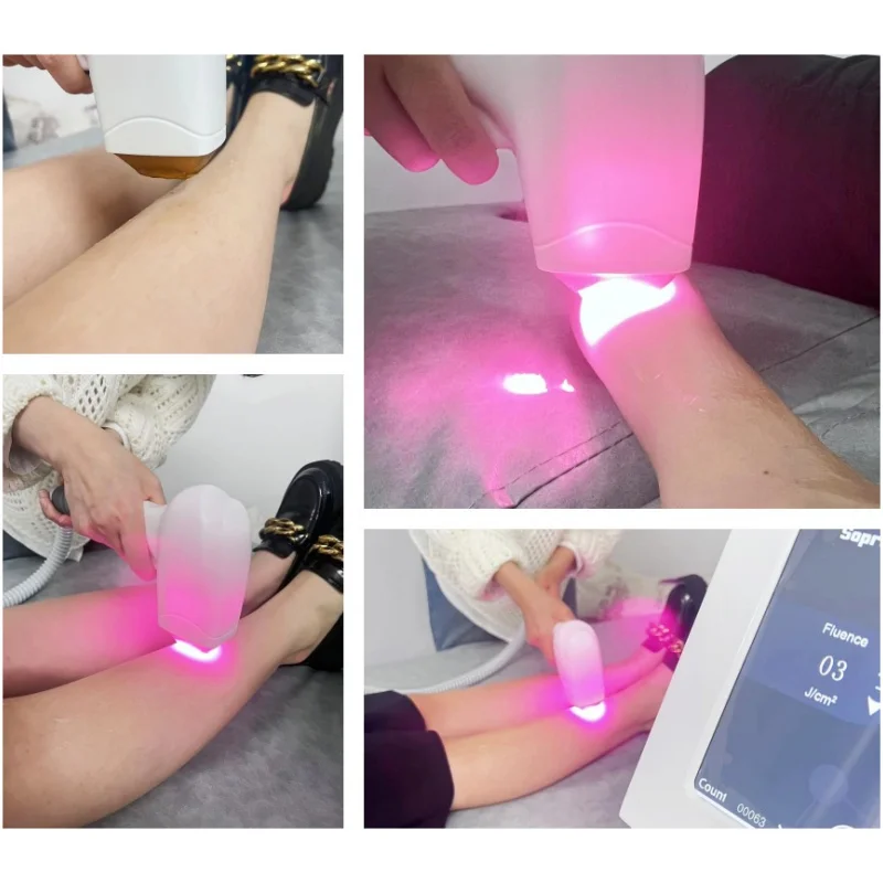 Macchina per la depilazione laser a diodi 3 lunghezze d\'onda 755 1064 808nm Laser Ice Platinum Depilazione permanente indolore Alexandrit CE