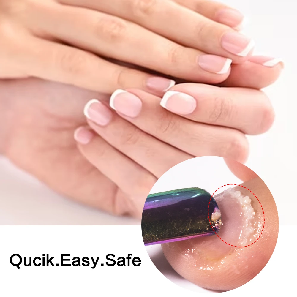 KODIES GEL dissolvant de cuticules instantané huile liquide adoucisseur de cuticules pour les ongles soins des ongles avec lanoline pied peau morte manucure pédicure