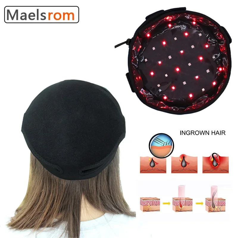 Regrowth Hair Cap Helmet with 70 LED Lamp Beads - Professional Treatment for Hair Loss and Growth