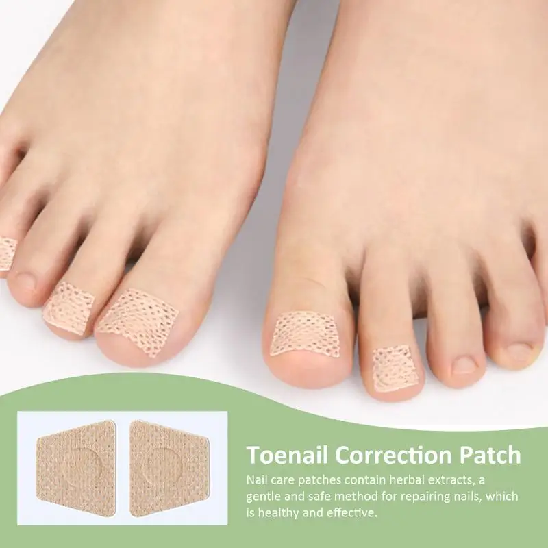 10 Stuks Teennagel Correctie Patch Nagel Vernieuwing Stickers Nagelreparatie Patches Voor Voetverzorging Gebroken Nagels Behandelingen Voetverzorging