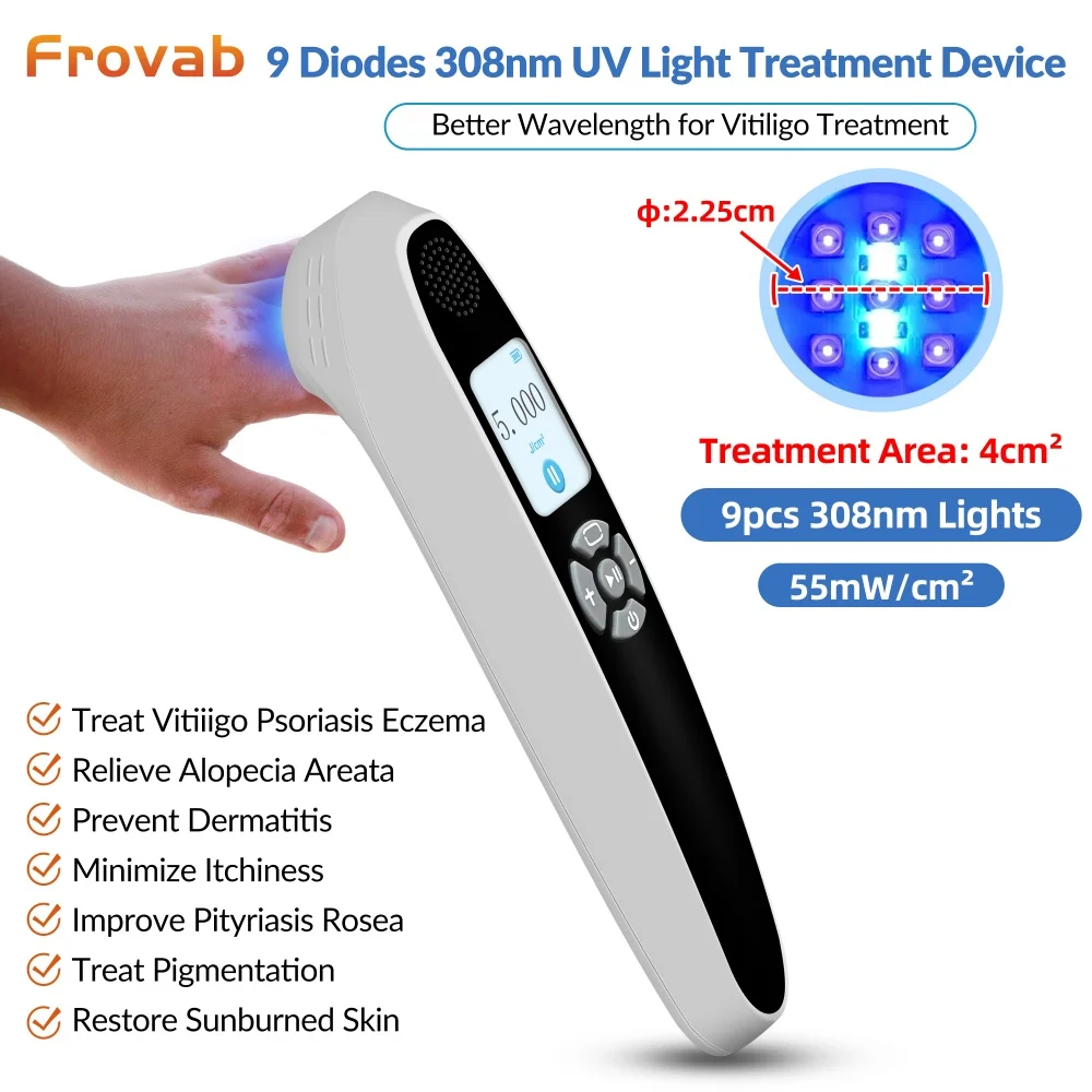

Лампа для фототерапии Frovab с целенаправленным излучением УФБ 308 нм, 9 диодов, 55 мВт/см², медицинский ультрафиолетовый свет для лечения витилиго и экземы