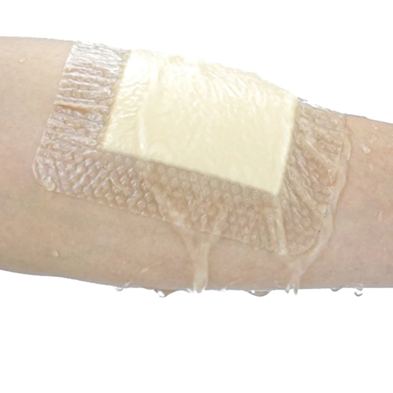 Almofada de cura estéril para escaras, cuidados com feridas, 5 tamanhos, curativo adesivo hidrocolóide