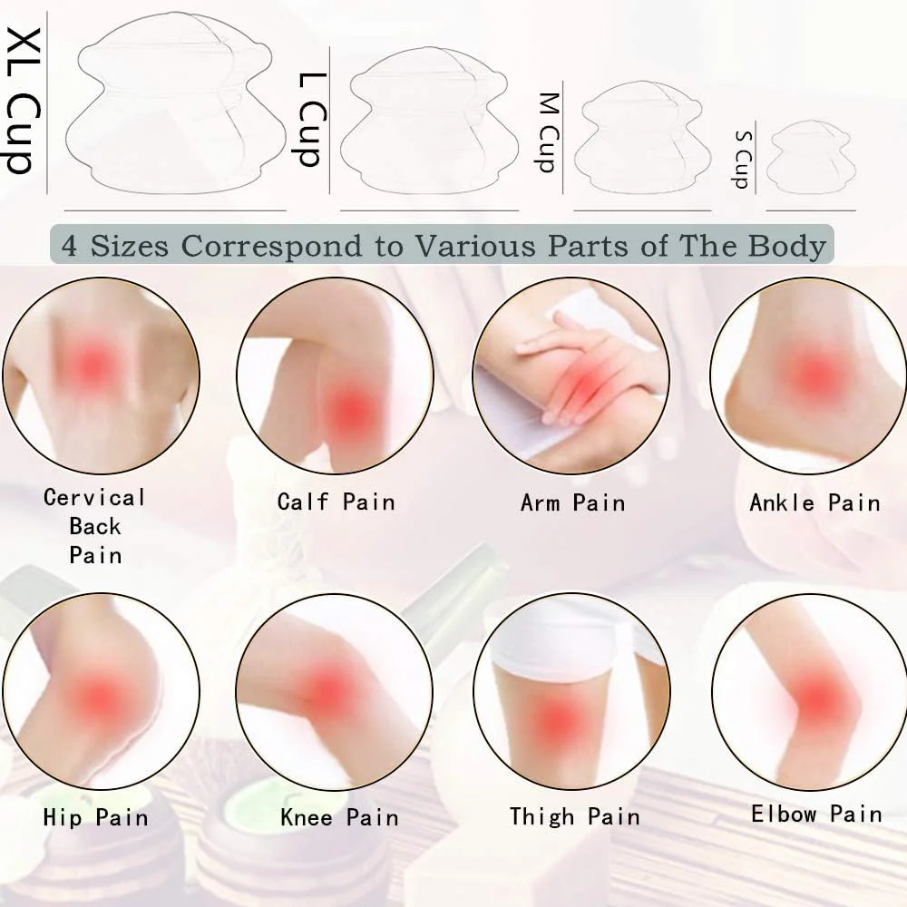Silikon-Schröpfset, professionelle Massage-Schröpfbecher für die Schröpftherapie zur Massage, myofasziale Entspannung, Cellulite-Reduktion – Detail 7