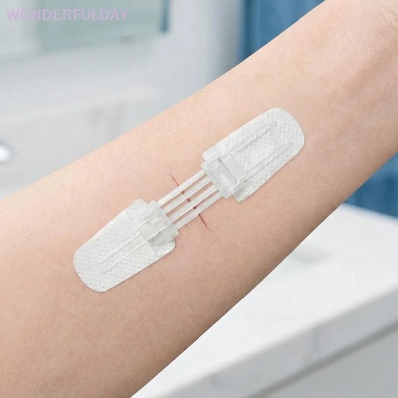 Neuer Reißverschluss-Wundverschluss-Patch: Schmerzfreier, nahtloser Wundverband – Zip-Suture-Reducer-Pflaster für unterwegs