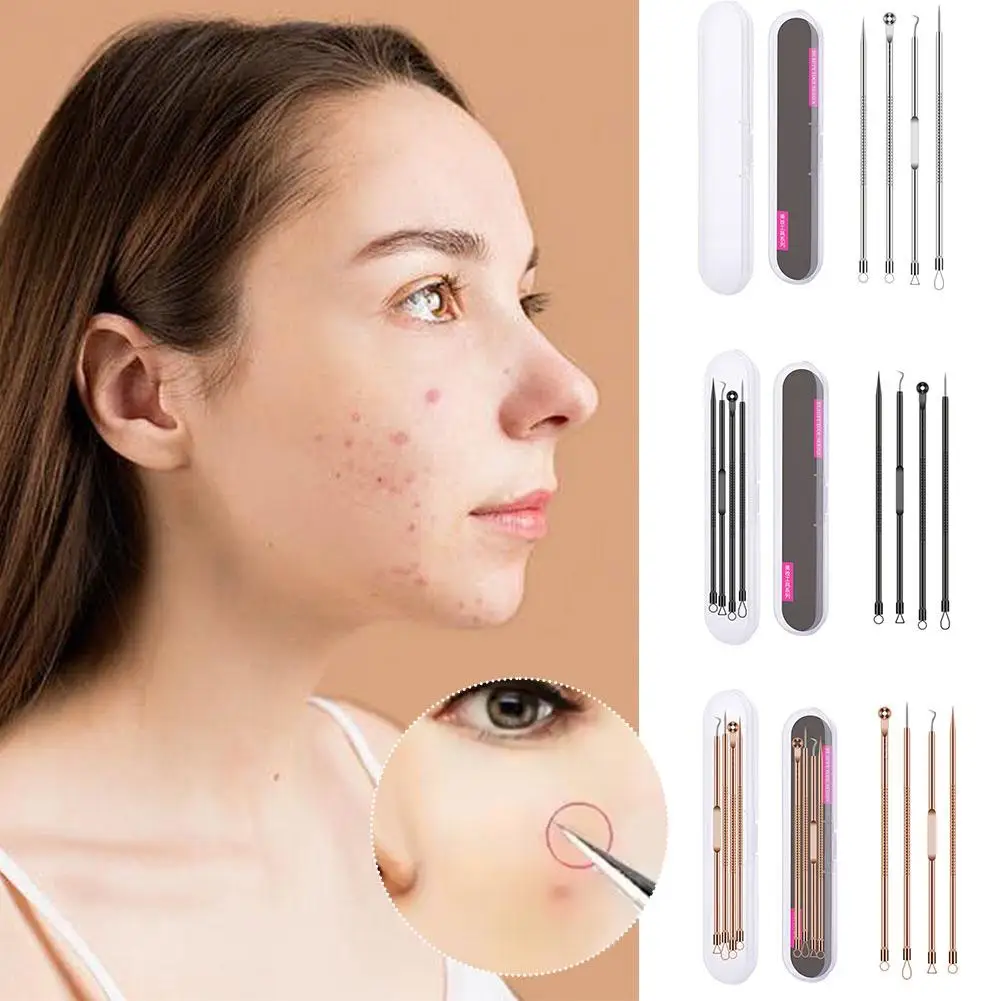 6-delige ultra-precieze puistjespincetset - Pro Acne- en mee-eterverwijderingstool - voor effectieve gezichtsverzorging en huidzuivering