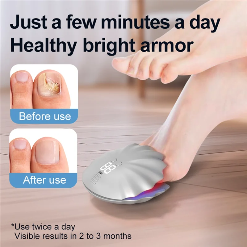 【CÓDIGO】Dispositivo de tratamiento láser para hongos en las uñas, limpieza de onicomicosis, reparación de hongos en los pies, eliminación de uñas encarnadas