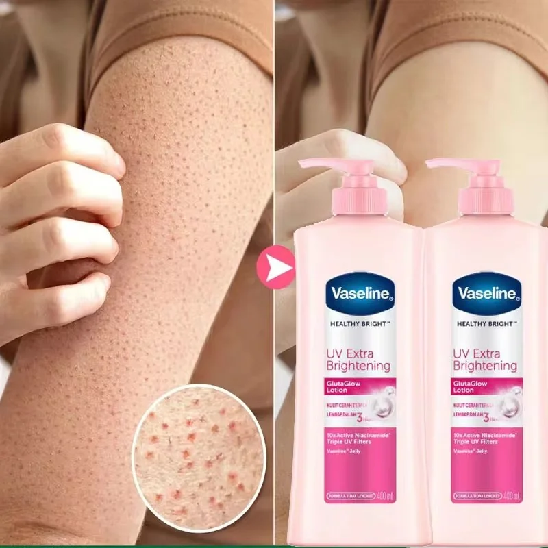 Vaseline Losion Tubuh Niacinamide, Losion Tubuh mengurangi pengelupasan kulit kering dan kering dan mencerahkan warna kulit 400ml