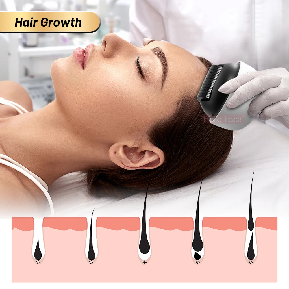 Hello Face Dermaroller 1200 Pin Microneedle Bio Roller G4 Hair Growth Body Stretch Marks Removal Skin care with Separate cover