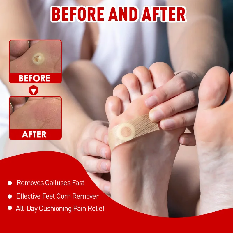 Corn Foot Toe Heel Callus Dead Skin Relief Cleaning Care Patches Adhesive Callus Cushion Non-woven Fabric Toe Corns Removal