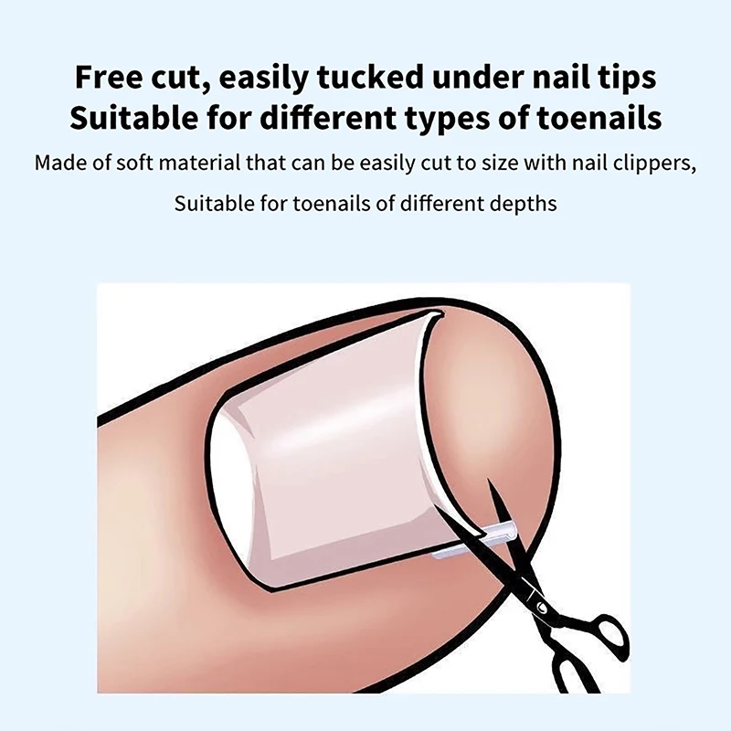 50 pièces traitement des ongles incarnés Patch élastique autocollant redressage pince orthèse pédicure outil outil de Correction des ongles incarnés
