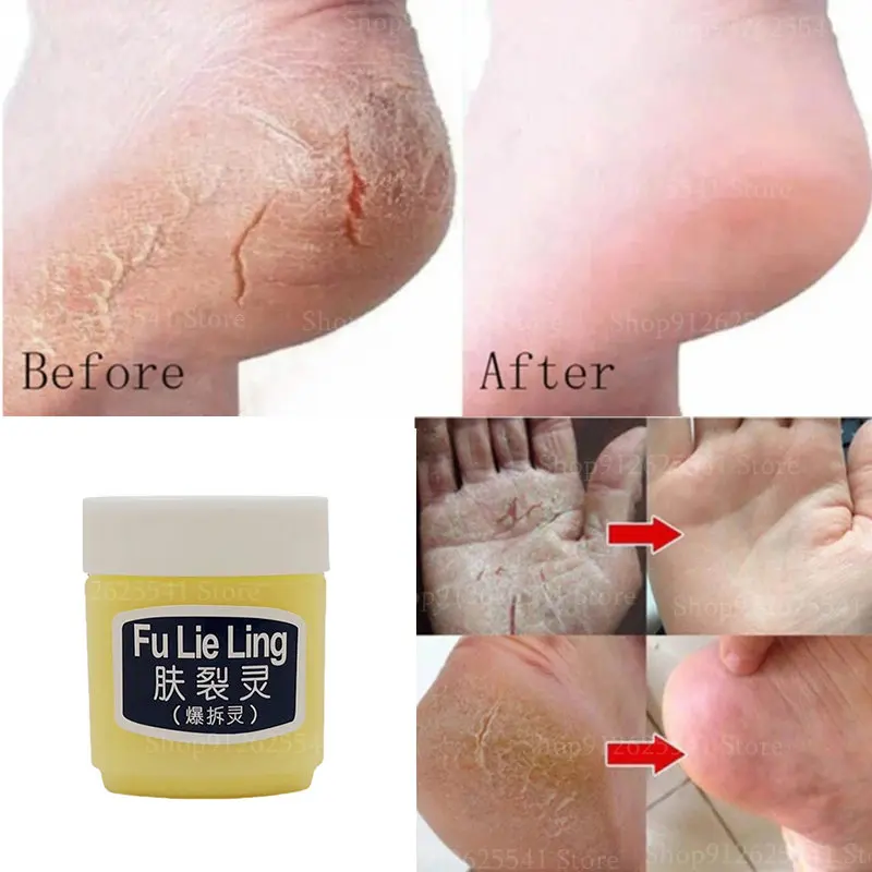 

45g Hand&Foot Cream Moisturizes Prevents Dry Skin Heel Cracked Repair Cream Removal Dead Skin Hand Feet Care Moisturizing Cream