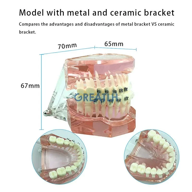 Dental Orthodontic Teeth Model Transparent Teeth Orthodontic Model with Brackets