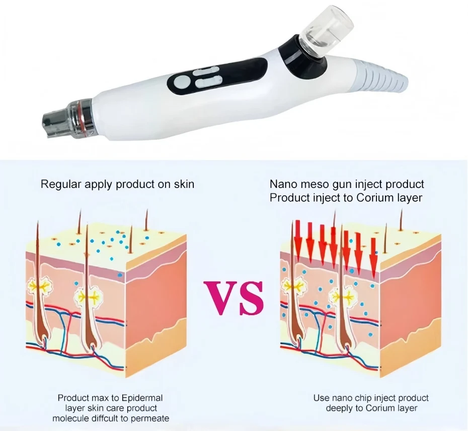 人気のEMS無針フェイシャルスキンリフティングRFニードルレスメソセラピー注入マシン、家庭用またはサロン用のメソナノガン