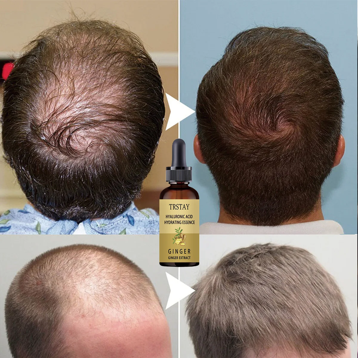 Hair Growth Serum Anti Preventing Hair Loss Alopecia Liquid Damaged Hair Repair Growing Faster - view 3