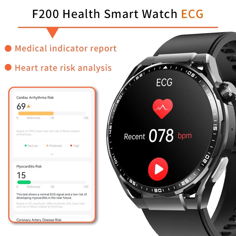 Smart Blood sugar watch 24h measurement of glucose, Blood pressure, Blood lipids, Uric acid, ECG, Wireless Bluetooth Smart APP