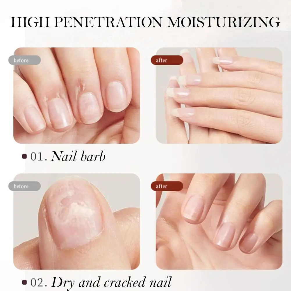 30g Intense nagelgroei en versterkend serum 7 dagen nagelgroei en versterkend serum Nagelversterker voor dunne nagels