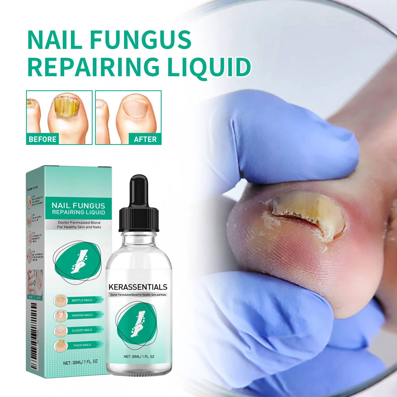 

Foot Toe Nail Fungus Removal Essential Oil Nail Fungal Treatment Serum Anti Infection Onychomycosis Paronychia Repairing Care