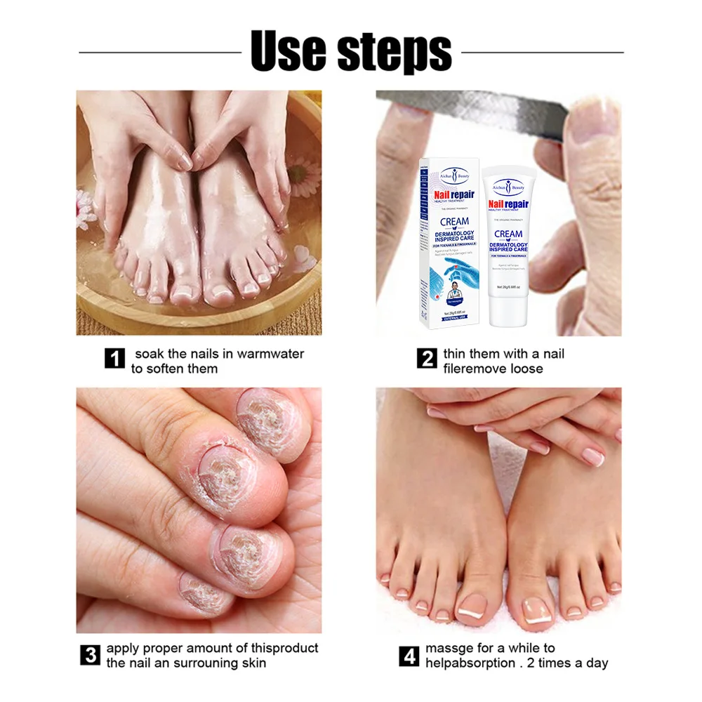 Extra Strong Nail Repair Cream Anti Infection Nail Fungus Treatments Feet Onychomycosis Repair Product Unisex Feet Care 20g