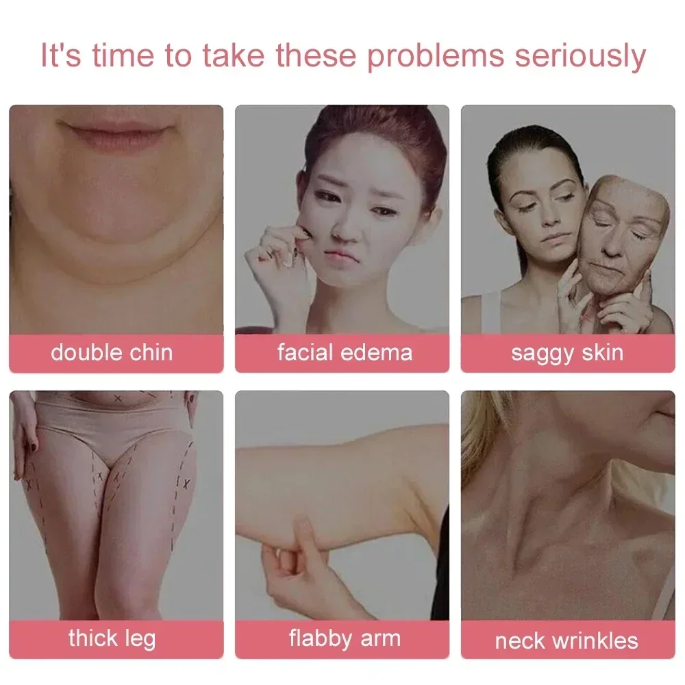 EMS أسطوانة رفع الوجه RF الذقن المزدوجة الخامس الوجه على شكل مدلك الوجه رقيقة التخسيس شد الوجه العناية بالبشرة الجمال المضادة للتجاعيد #2