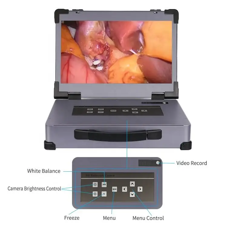 High Quality 3-in-1 Endoscopy Portable Endoscopy Camera System Hot Sale Endoscopy Camera System