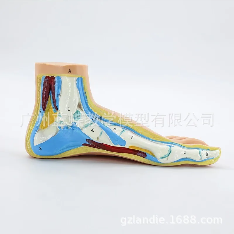 Medical Human  Sketelon  Flatfoot, Arch Foot and Normal Foot Anatomy Model with Muscles and Joints for Educational Purposes