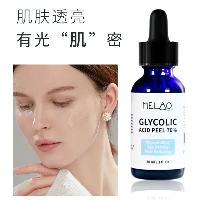 Glycolic Acid Peel 70% Skin Reshaping Repair Pores Invisible Brightens Complexion Acne Treatment Skin Care skin whitening beauty