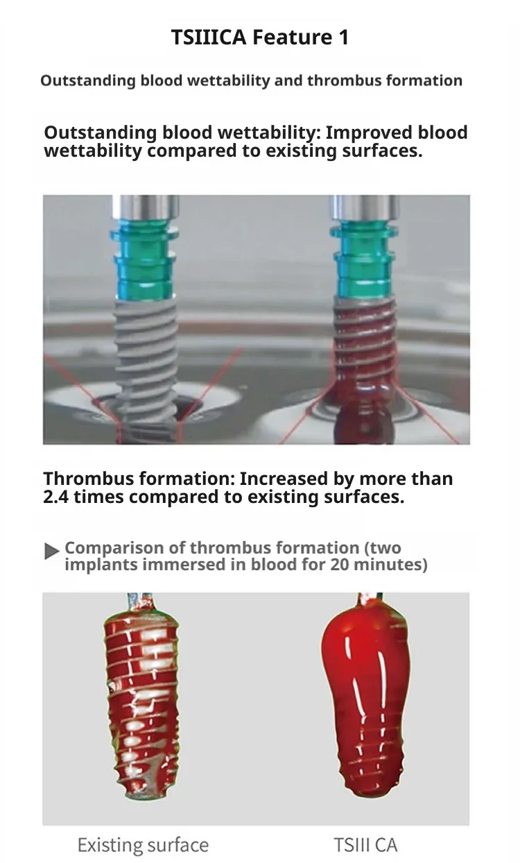 Osstem TSⅢ CA Hydrophilic Implant Fixture, CA Calcium Activated Surface for Rapid Bone Healing Dental Surgical Instrument