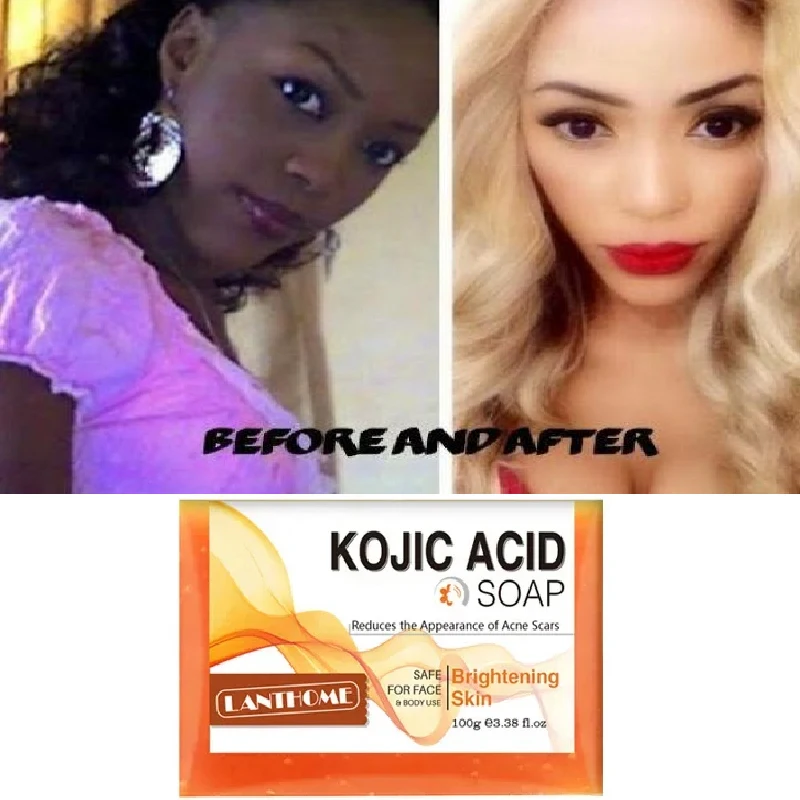 

100g Kojic Acid Soap Original Face Whitening Soap Skin Care Brighten Anti Aging Acne Remove Dark Spot Moisturizing Cleansing