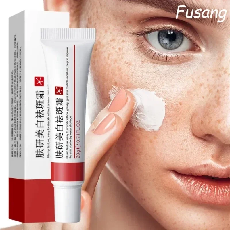 Dark Spot Remover for Face Removing Freckle Chloasma Senile Plaques Sunburn Cyasma Chorioplaque Freckle Cream