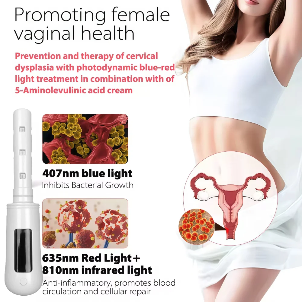 عصا تجديد المهبل للمهبل البكتيري 630 نانومتر الضوء الأحمر و465 نانومتر جهاز العلاج بالضوء الأزرق جهاز العلاج بالأمراض النسائية المشدود