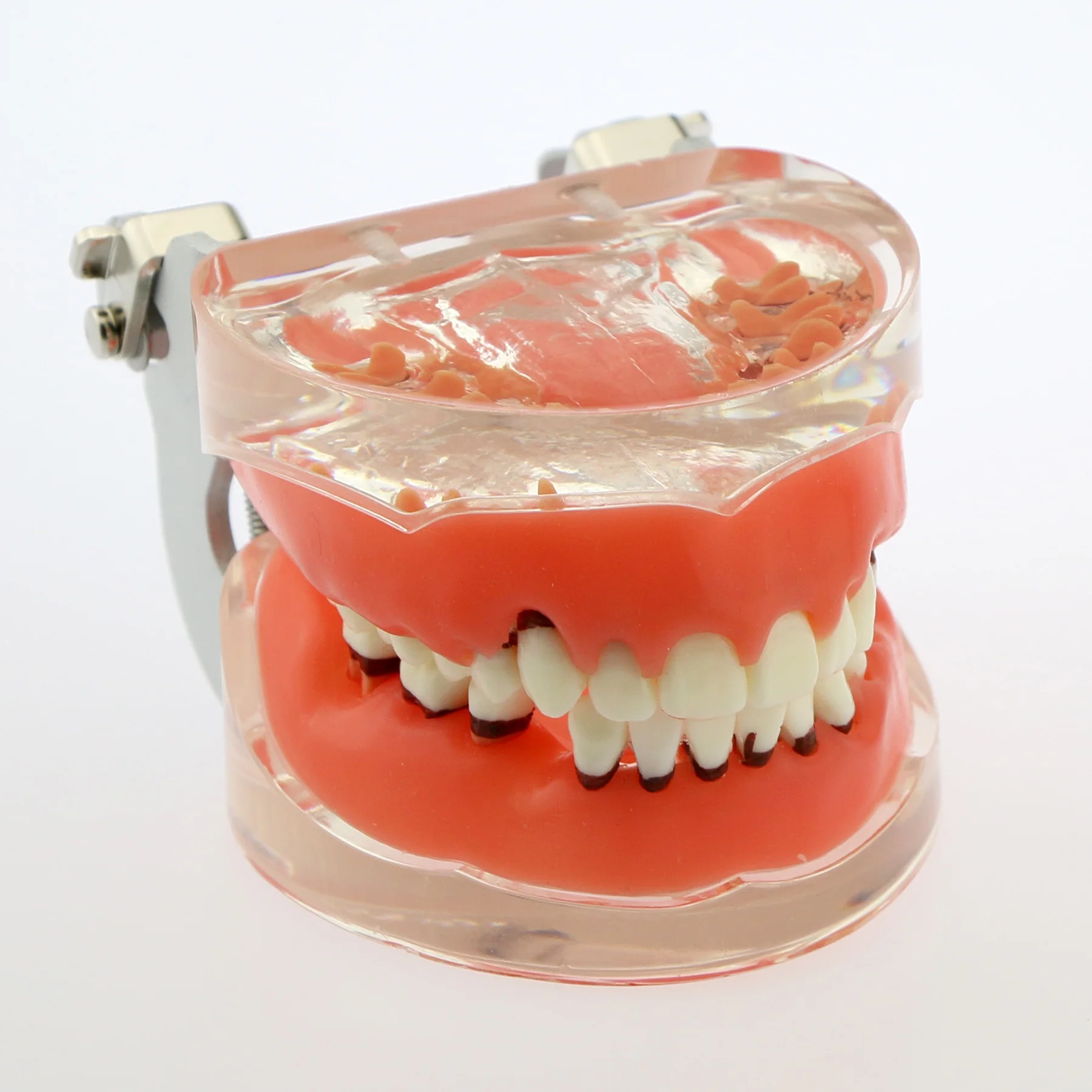 Dental Teeth Model Dental Periodontal Disease Gingivas Recession Dentists Teaching Model Demonstration