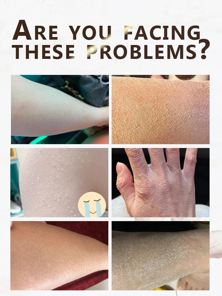 

Dry skin is effective, it is recommended to be kind to yourself, massage and relax more.