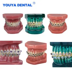 Dentystyczne ze wspornikiem ortodontycznym Model zębów metalowo/ceramicznym samozamykające się leczenie stomatologiczne do nauczania studiowania Demo