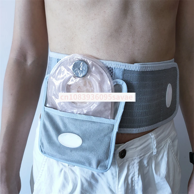 Self-Adhesive Anti-Breathable Belt Anti-Head Convex Fixed with Guard Plate