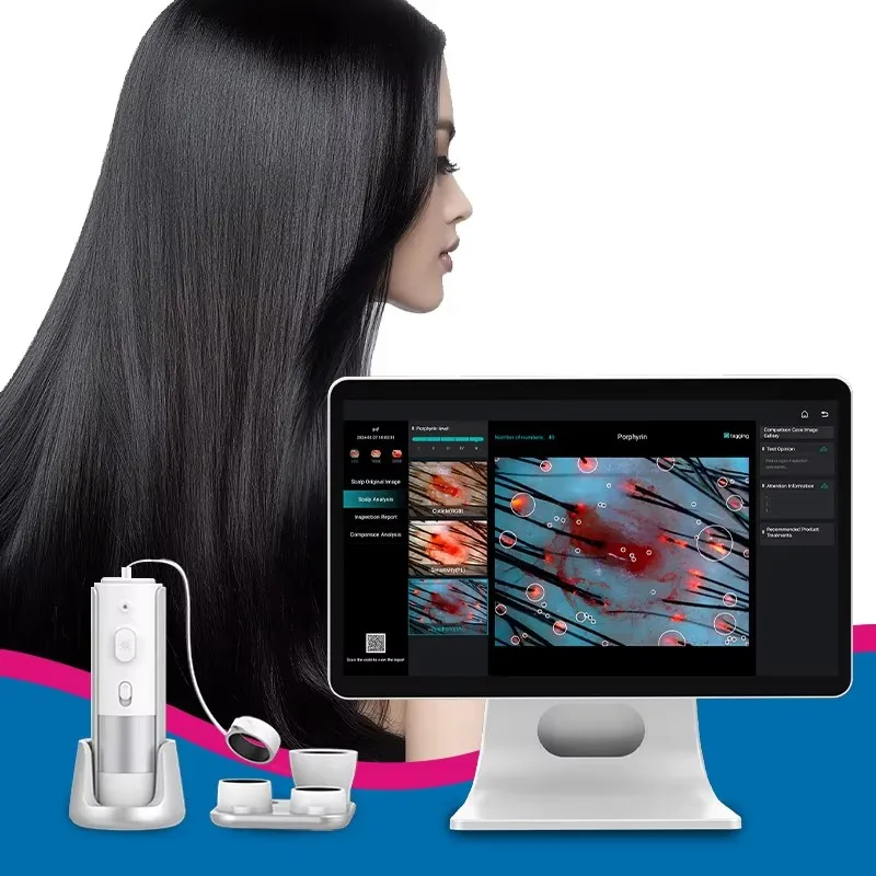 

Intelligent Ai Hair Detector Scalp Hair 15.6 Inch Color Touch Screen Medical Hair Mirror Analyzer Device