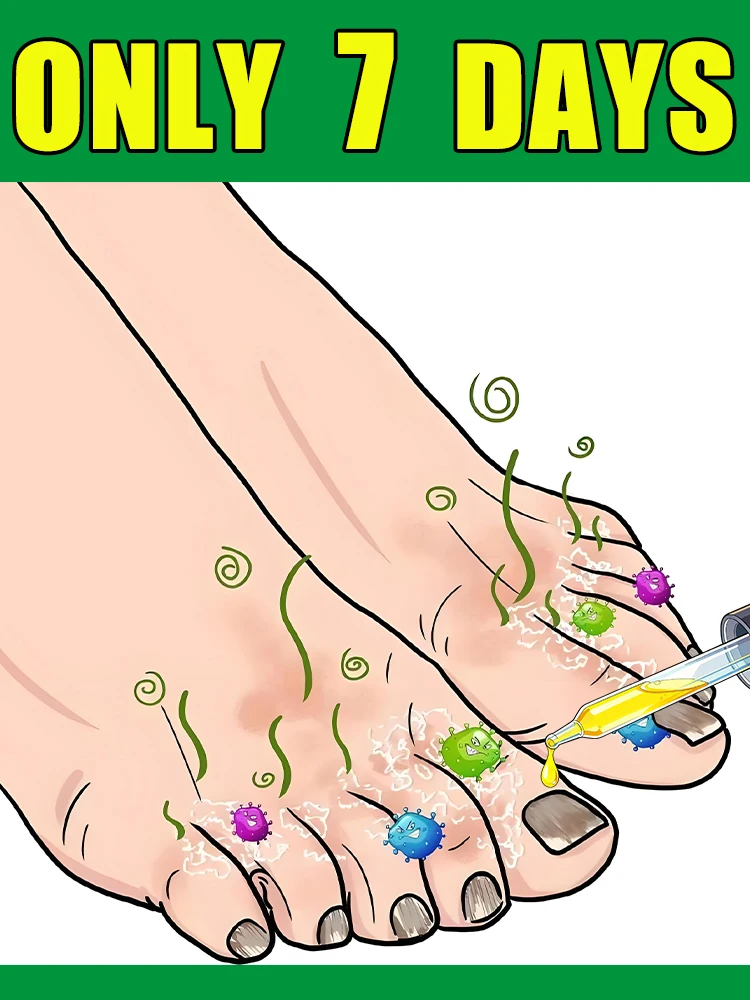 2025년 빠르게 곰팡이를 제거하고 건강한 손톱을 복원합니다