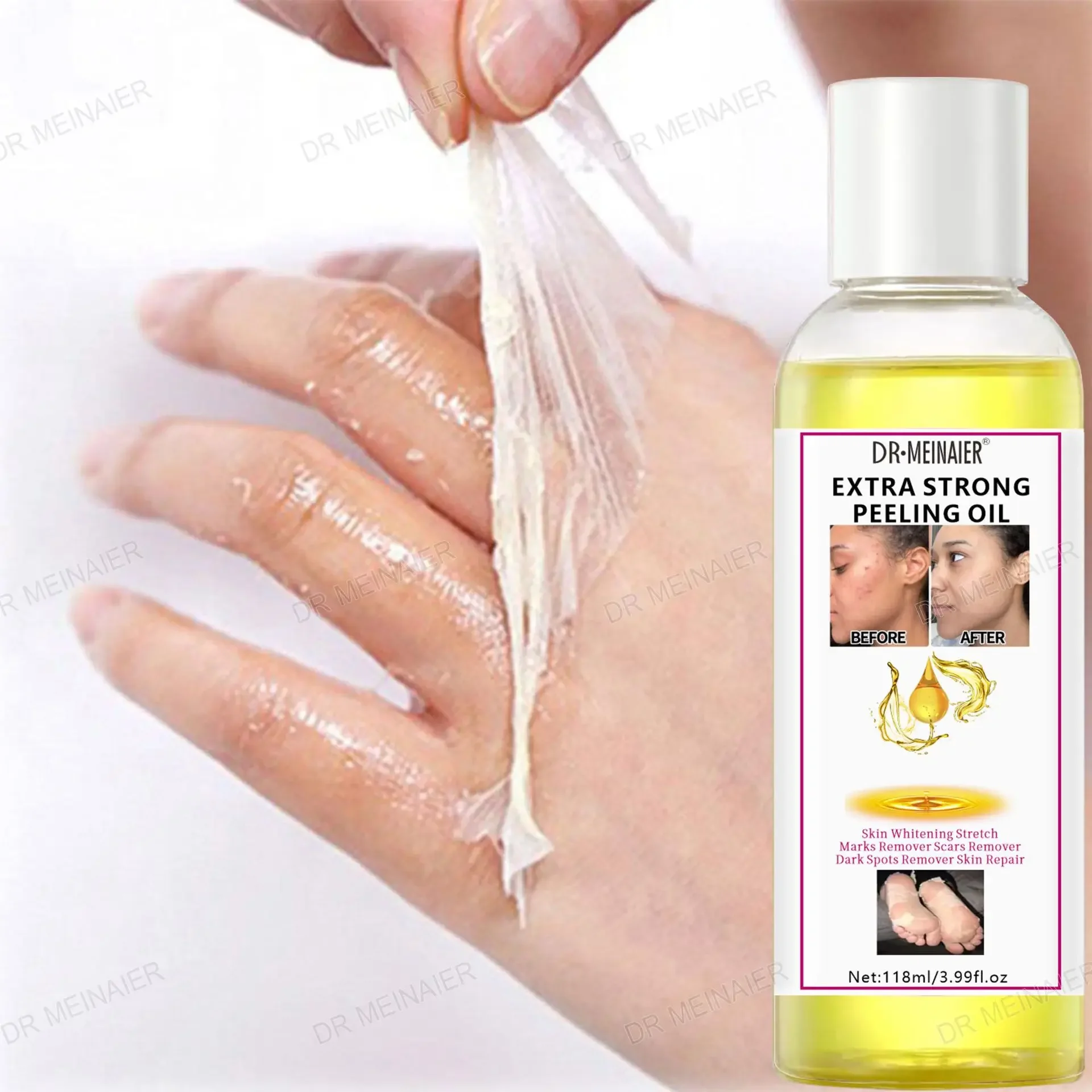 1 Bottle Skinning Oil for Whitening Exfoliating Lightening and Brightening Skin Hands Face and Body Care Whitening Skin Care