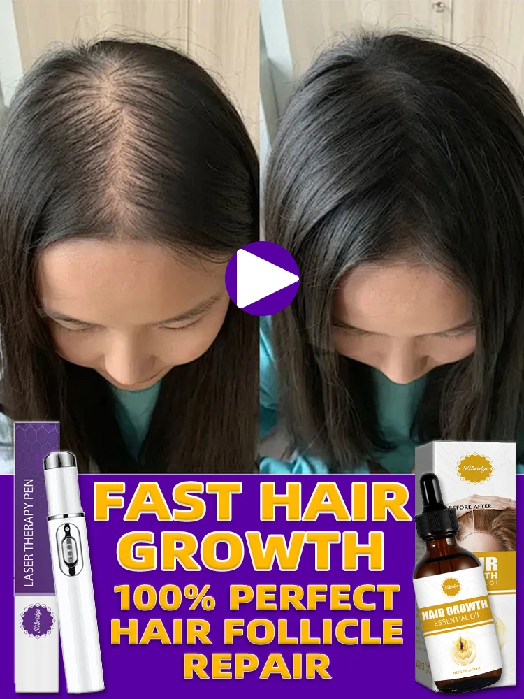 Laser hair follicle repair for fast hair growth