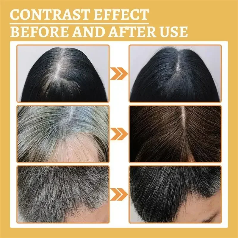 Gray White Hair Treatment Serum Liquid White To Black Natural Color Repair Nourish Product Anti Loss Hair Care Men Women