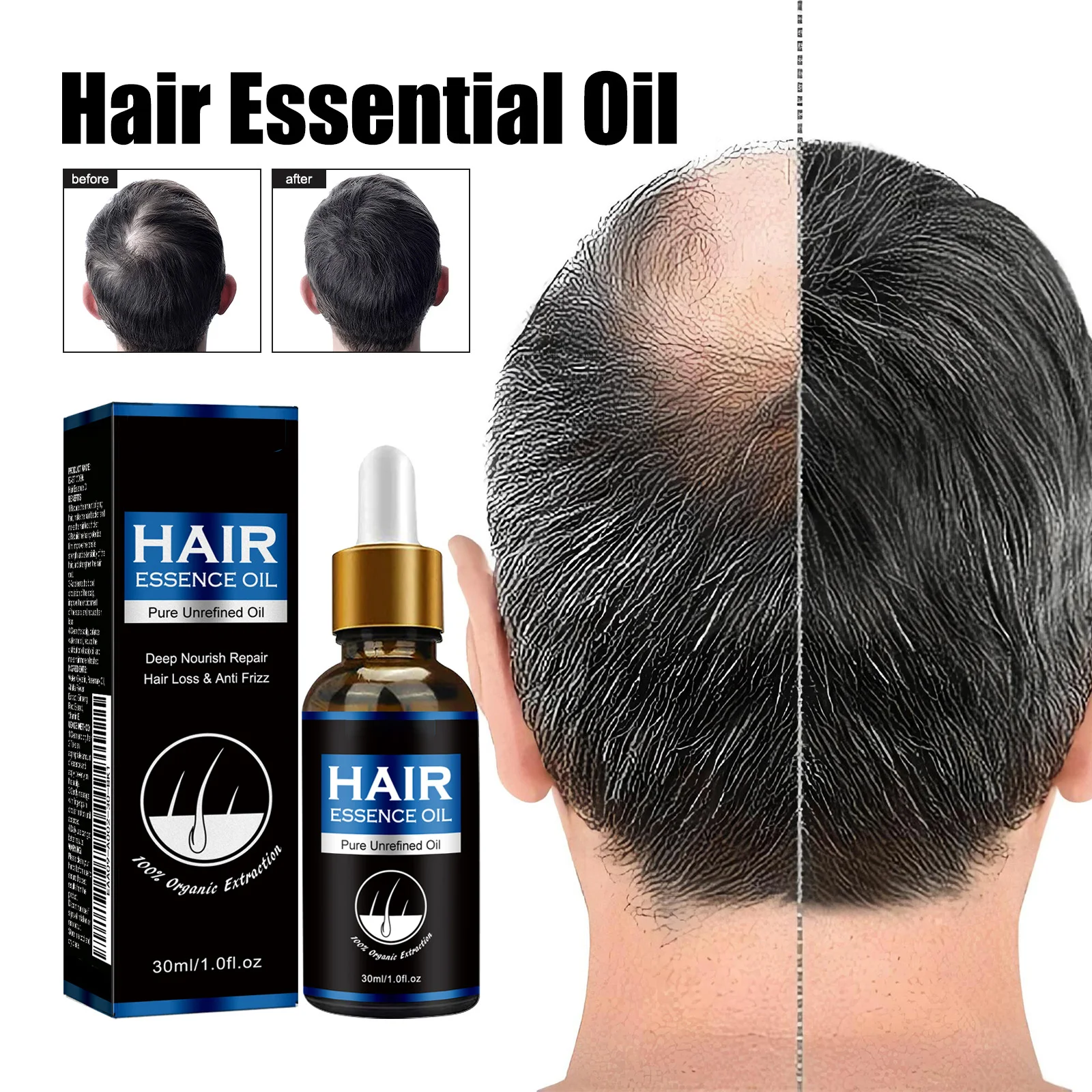 Hair Growth Oil Effective Rapid Repair Fast Baldness Postpartum Hair Loss Follicles Hereditary Loss Hair Care Solution