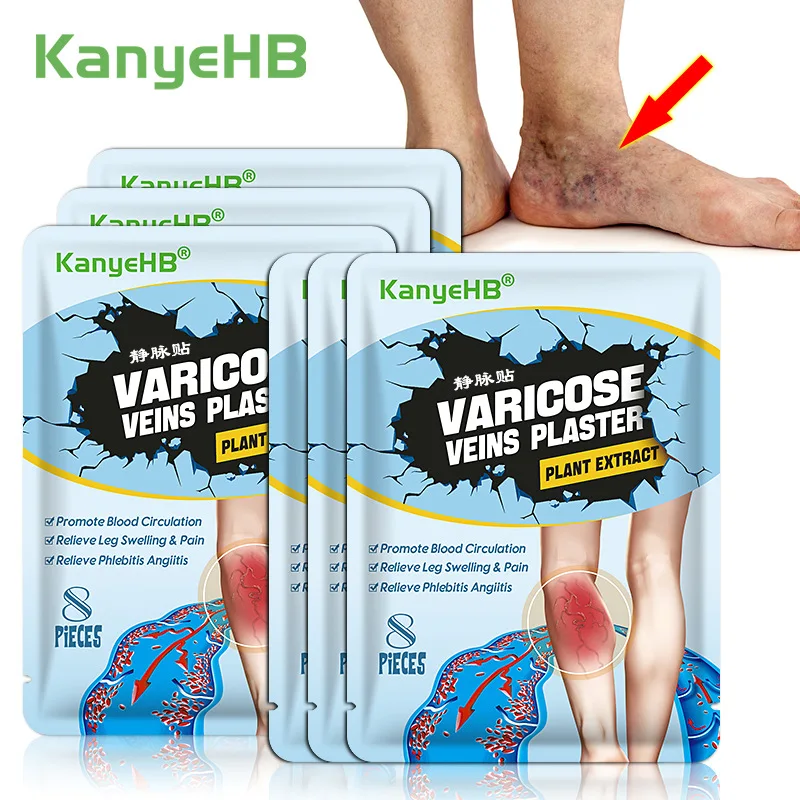 8PCS/Bag Effective Varicose Veins Treatment Patch Legs Sore Swelling Plaster Promote Metabolism Promote Smooth Blood Circulation