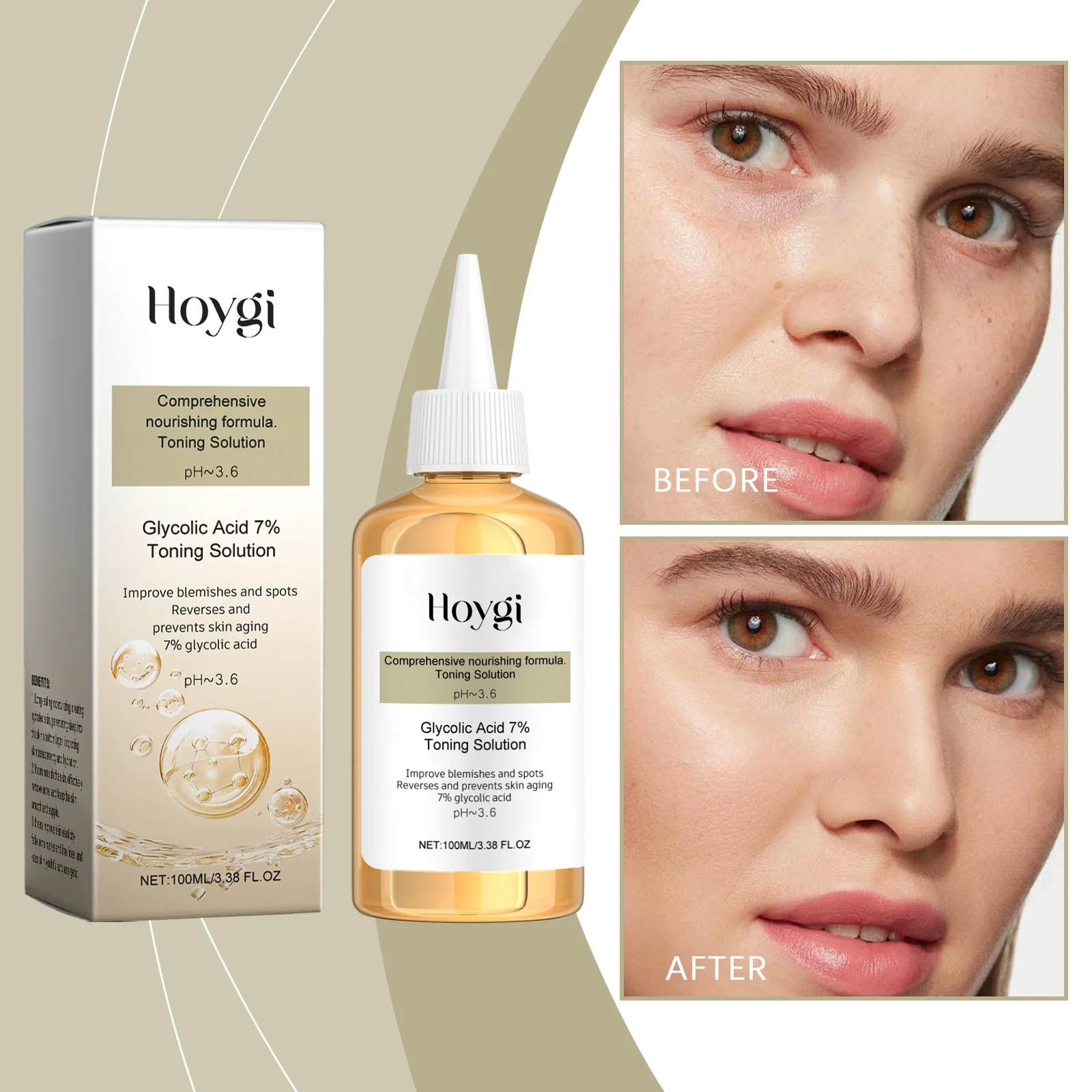 

Effective Acne Removal and Mouth Closure Toner Solution with Glycolic Acid Herbal Extracts for Even Skin Tone and Refined Pores