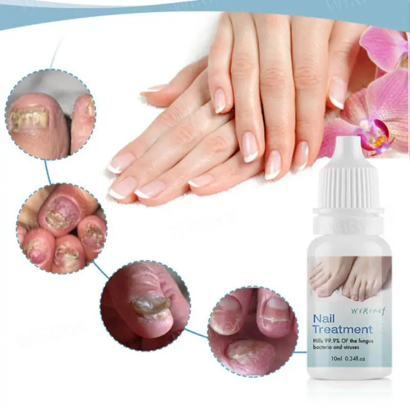 Toe Nail Fungus Remover Fast Acting Revolutionary Nail Fungus For Men Anti Nail Fungus Cure Popular Powerful