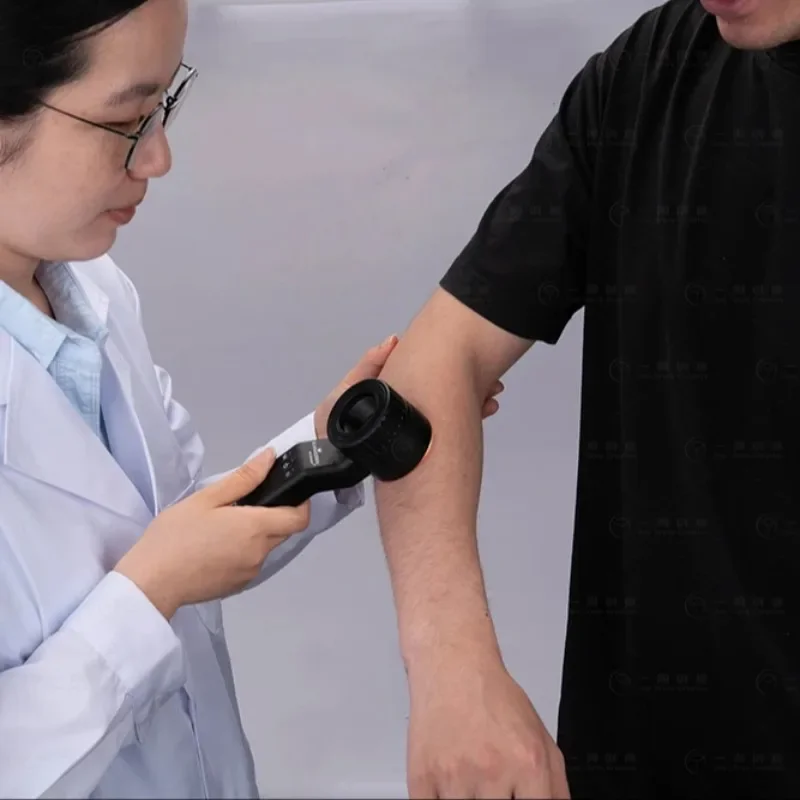 

IBOOLO DE-4100 The World's Best Handheld Dermoscope for Melanoma Diagnosis