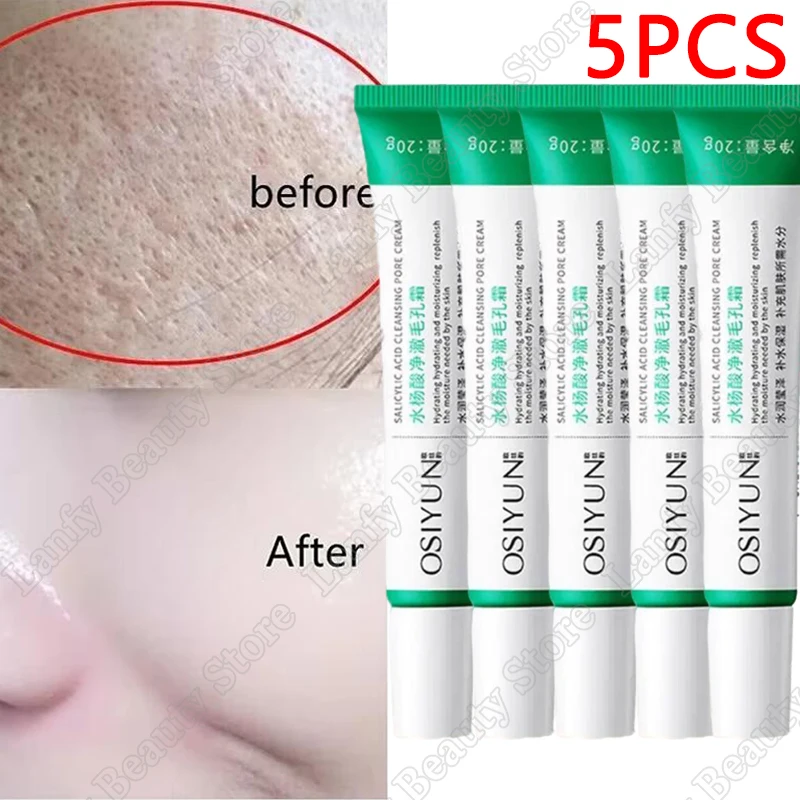 Salicylic Acid Pore Clearing Cream Shrink Pores Remove Blackheads Acne Brighten Moisturizing Smooth Skin Care Korean Products