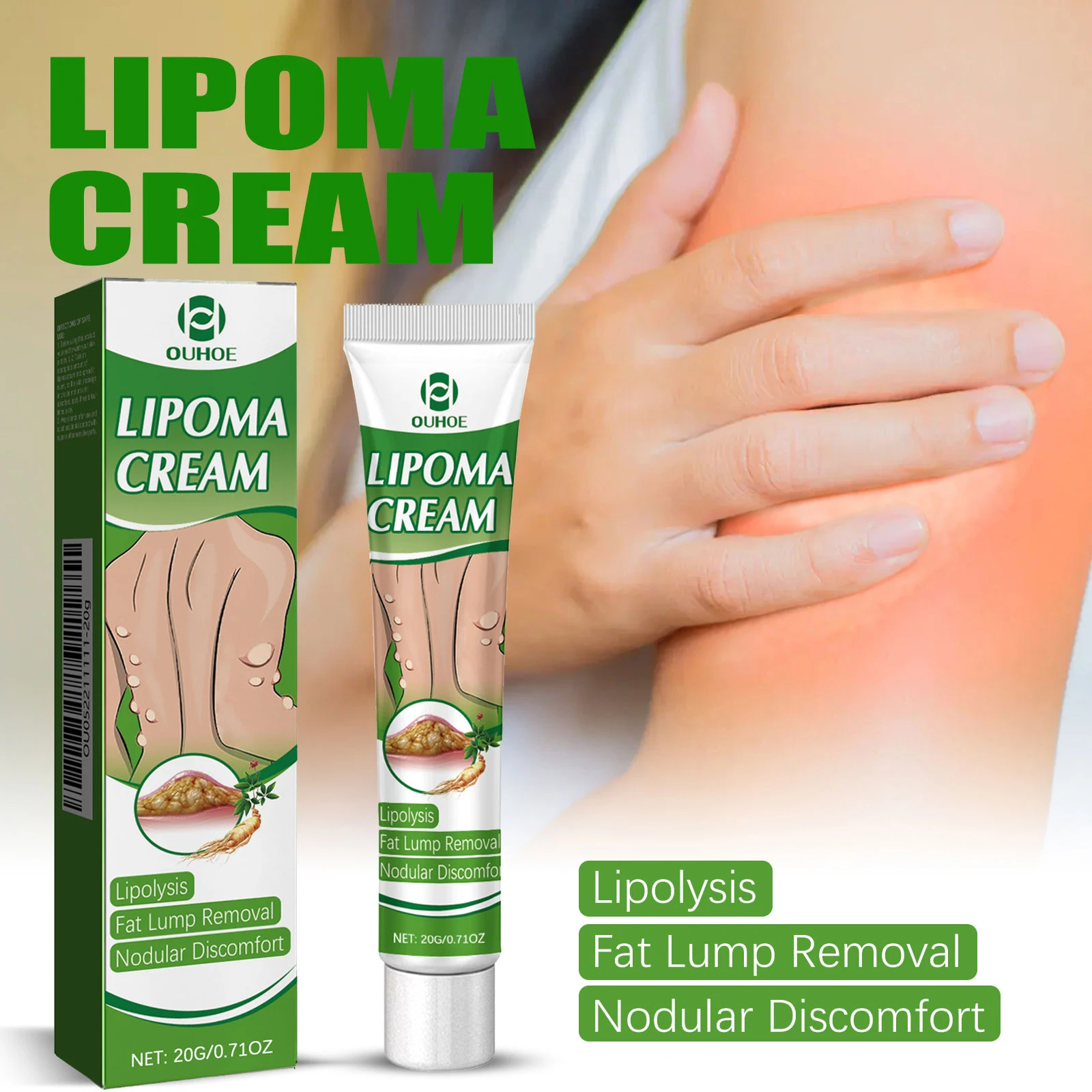 OUHOE Lipoma Cream 20g Herbal Extract Fat Lump Relief Cream Subcutaneous Nodular Discomfort Body Skin Care Ointment